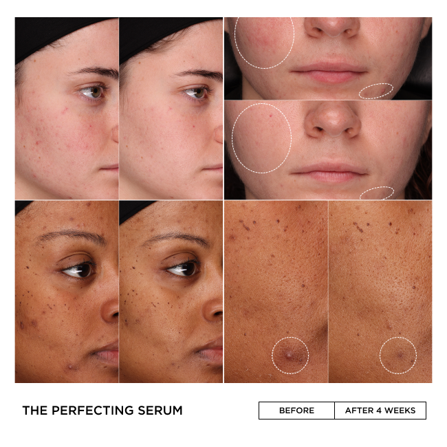 THE PERFECTING SERUM