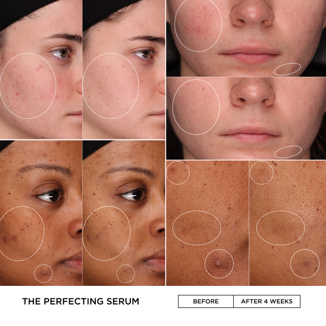 Before and after comparison of skin treatment with &