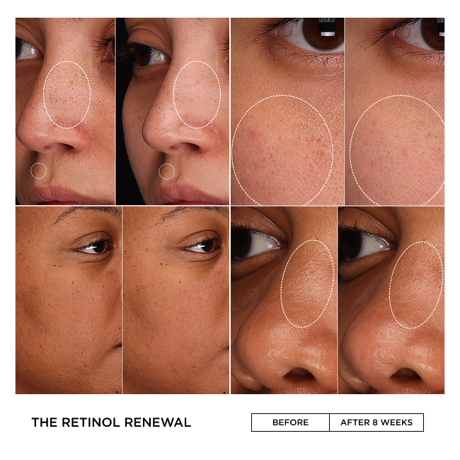 THE RETINOL RENEWAL