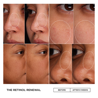THE RETINOL RENEWAL