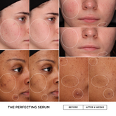 Before and after comparison of skin treatment with &
