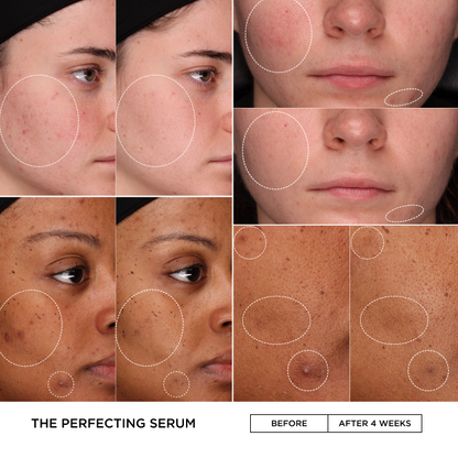 Before and after comparison of skin treatment with &